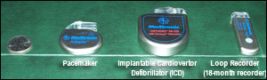 Pacemaker, Implantable Cardiovertor Defibrillator (ICD), and Loop Recorder (18-month recorder)